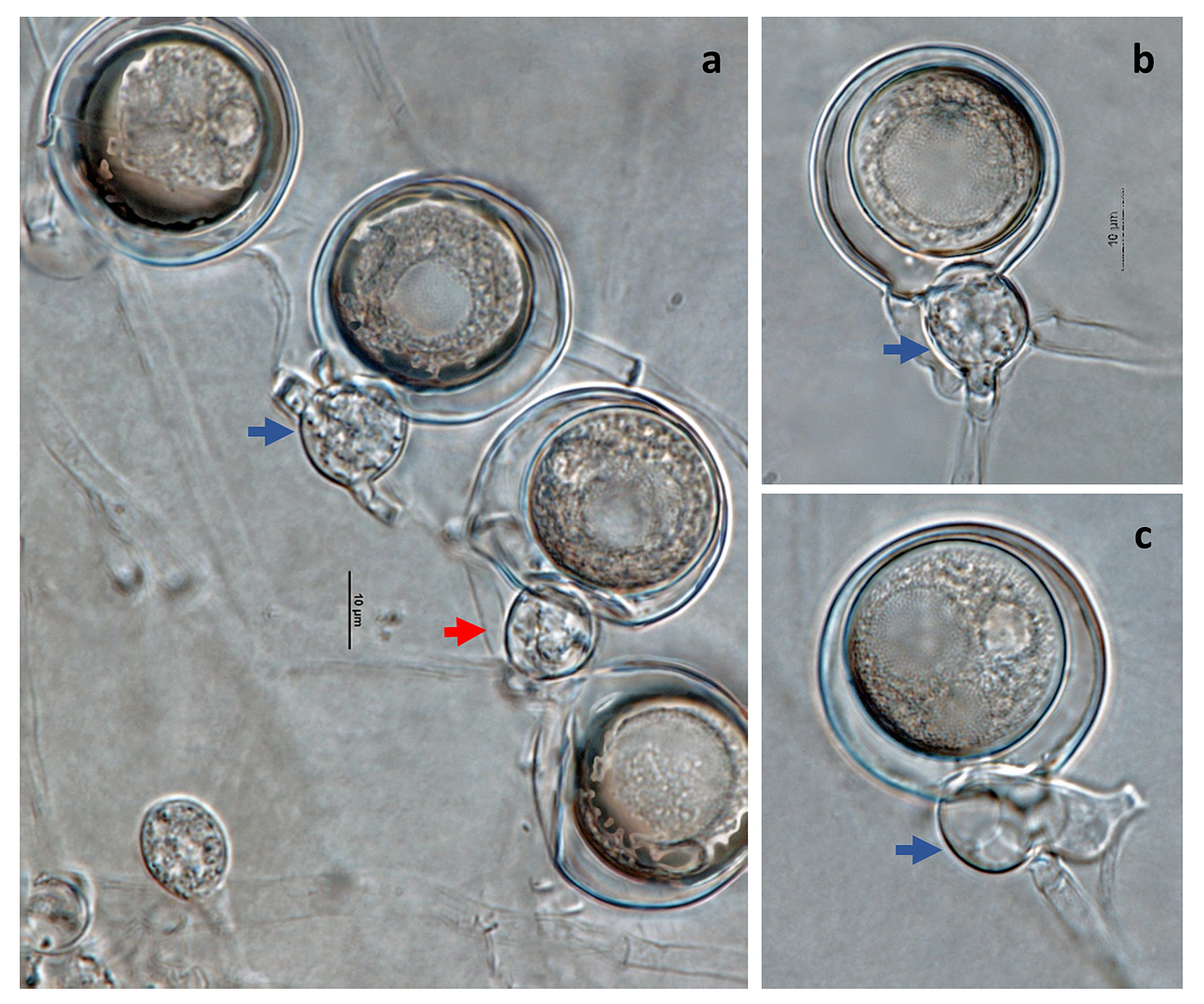   Phytophthora lilii nbsp;(ex-type CPHST BL 123 = CBS 135746) sexual phase: (andash;c) smooth-walled oogonia with aplerotic oospores, (blue arrows) paragynous antheridia, (red arrow) amphigynous antheridia rarely produced; photos by Gloria Abad, USDA-APHIS-PPQ. 
